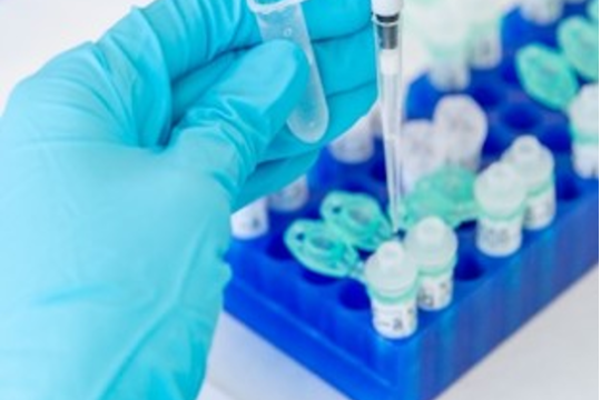 Règlement (CE) N°2073/2005 - Sécurité microbiologique des PDM : les critères incontournables de l’UE (Teneur en Histamine)